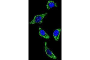 Confocal immunofluorescent analysis of TNFRSF1A Antibody (N-term) with U-251MG cell followed by Alexa Fluor 488-conjugated goat anti-rabbit lgG (green). (TNFRSF1A antibody  (N-Term))