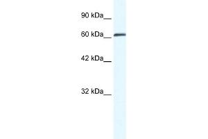 ZMYM6 antibody  (Middle Region)