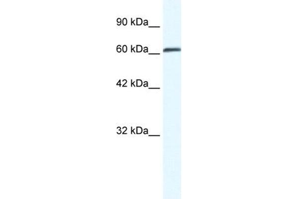 ZMYM6 antibody  (Middle Region)