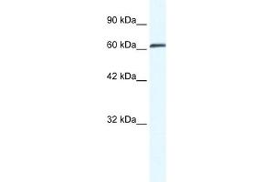 WB Suggested Anti-ZNF258 Antibody Titration:  0.