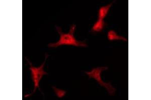 ABIN6267477 staining SW626 by IF/ICC. (CTNNB1 antibody  (pSer37))