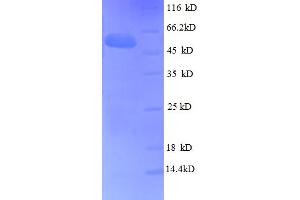 SDS-PAGE (SDS) image for Fibroblast Growth Factor 5 (FGF5) (AA 18-268) protein (GST tag) (ABIN5712688)