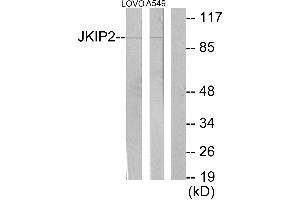 Immunohistochemistry analysis of paraffin-embedded human brain tissue using JKIP2 antibody.