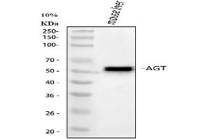 Western blot analysis of Angiotensinogen using anti-Angiotensinogen antibody (ABIN5518727).