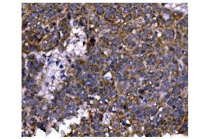 IHC analysis of PFKFB2 using anti-PFKFB2 antibody (ABIN7601627).