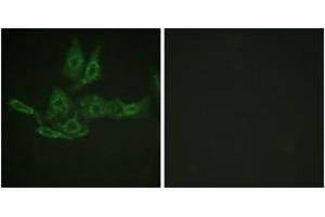 Immunofluorescence analysis of HepG2 cells, using BCL-2 (Ab-69) Antibody. (Bcl-2 antibody  (AA 46-95))