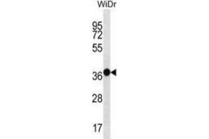 Western blot analysis in WiDr cell line lysates (35ug/lane) using Mucin-15 Antibody (C-term). (MUC15 antibody  (C-Term))