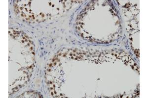 Immunoperoxidase of monoclonal antibody to PBK on formalin-fixed paraffin-embedded human testis. (PBK antibody  (AA 1-110))