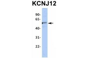 Host:  Rabbit  Target Name:  KCNJ12  Sample Type:  Human Fetal Heart  Antibody Dilution:  1. (Kir2.2 antibody  (Middle Region))