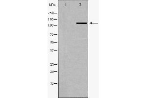 Western blot analysis of A549 whole cell lysates, using SLC4A4 Antibody. (SLC4A4 antibody  (C-Term))