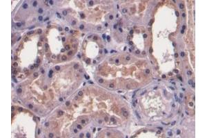 Detection of F1+2 in Human Kidney Tissue using Monoclonal Antibody to Prothrombin Fragment 1+2 (F1+2) (Prothrombin Fragment 1+2 antibody)