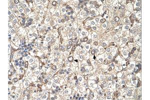 Immunohistochemistry (IHC) image for anti-ST3 beta-Galactoside alpha-2,3-Sialyltransferase 4 (ST3GAL4) (Middle Region) antibody (ABIN2782704) (ST3GAL4 antibody  (Middle Region))