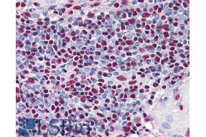 ABIN185611 (5µg/ml) staining of paraffin embedded Human Spleen. (XRCC5 antibody  (Internal Region))
