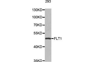 Western blot analysis of extracts of 293 cell line, using FLT1 antibody. (FLT1 antibody  (AA 1100-1200))