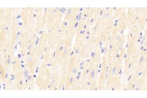 Detection of SIRT2 in Mouse Cardiac Muscle Tissue using Polyclonal Antibody to Sirtuin 2 (SIRT2) (SIRT2 antibody  (AA 65-340))
