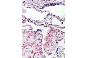 Immunohistochemical staining of formalin-fixed, paraffin-embedded human lung (A) and human placenta (B) tissue after heat-induced antigen retrieval. (C5AR1 antibody  (Internal Region))