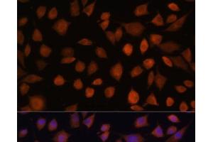 Immunofluorescence analysis of L929 cells using ARMC6 Polyclonal Antibody at dilution of 1:100. (ARMC6 antibody)