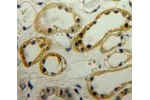 Used in DAB staining on fromalin fixed paraffin-embedded Kidney tissue (LIMS1 antibody  (AA 68-303))