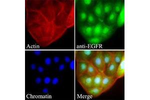 Image no. 3 for anti-Epidermal Growth Factor Receptor (EGFR) (AA 424-605) antibody (ABIN782452)