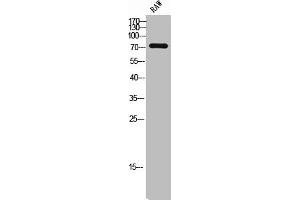 Western Blot analysis of RAW cells using NHE-6 Polyclonal Antibody (SLC9A6 antibody  (Internal Region))