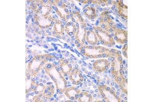 Immunohistochemistry of paraffin-embedded rat kidney using ALDH1A2 antibody. (ALDH1A2 antibody  (AA 1-180))