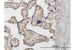 Immunohistochemistry (Formalin-fixed Paraffin-embedded Sections) (IHC (fp)) image for anti-Sorting Nexin 1 (SNX1) (AA 1-522) antibody (ABIN948488)