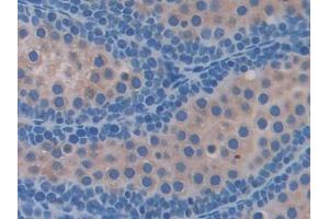 Immunohistochemistry (IHC) image for anti-Ferritin, Mitochondrial (FTMT) (AA 54-229) antibody (ABIN7437572)