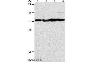 Western blot analysis of Mouse stomach, heart and liver tissue, HT-29 cell, using MMP15 Polyclonal Antibody at dilution of 1:200 (MMP15 antibody)