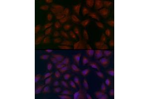 Immunofluorescence analysis of U2OS cells using SLC27 Rabbit pAb (2847) at dilution of 1:100 (40x lens). (SLC27A1 antibody  (AA 347-646))
