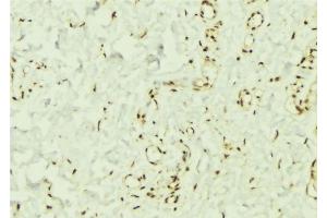ABIN6269332 at 1/100 staining Mouse muscle tissue by IHC-P.