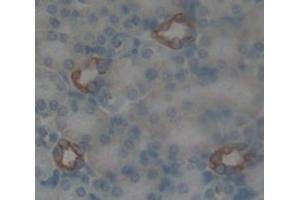 Figure. (CRYBB1 antibody  (AA 17-191))