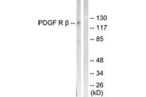 Western blot analysis of extracts from LOVO cells, treated with H2O2 100uM 30', using PDGFR beta (Ab-1021) Antibody. (PDGFRB antibody  (AA 991-1040))