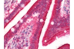 Human Small Intestine: Formalin-Fixed, Paraffin-Embedded (FFPE)