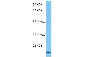 Host:  Rabbit  Target Name:  GRHL3  Sample Tissue:  Human 786-0 Whole Cell  Antibody Dilution:  1ug/ml (GRHL3 antibody  (C-Term))