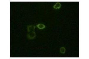 Immunofluorescence staining of methanol-fixed Hela cells using ABL2 mouse mAb showing cytoplasm localization. (ABL2 antibody)