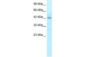 RGS20 antibody used at 5 ug/ml to detect target protein. (RGS20 antibody  (N-Term))