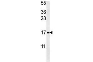 CCL4 antibody western blot analysis in mouse bladder tissue lysate (15ug/lane). (CCL4 antibody  (AA 22-48))