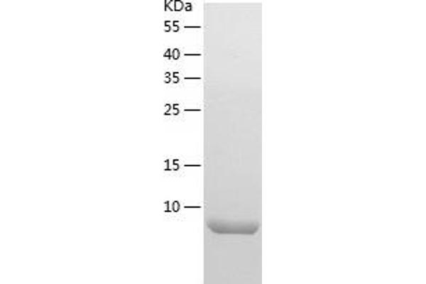 IRF5 Protein (AA 176-240) (His tag)