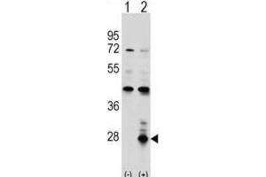 Western Blotting (WB) image for anti-Azurocidin 1 (AZU1) antibody (ABIN2998391) (Azurocidin antibody)