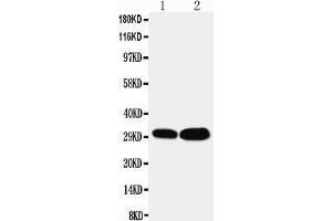 Anti-LASP1 antibody,  Western blotting Lane 1: HELA Cell Lysate Lane 2: MCF-7 Cell Lysate (LASP1 antibody  (N-Term))