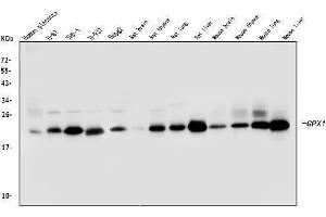 Western blot analysis of GPX1 using anti-GPX1 antibody (ABIN6719520).