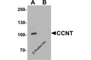 Western Blotting (WB) image for anti-Cyclin T1 (CCNT1) (C-Term) antibody (ABIN1077437) (Cyclin T1 antibody  (C-Term))