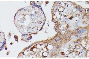 Immunohistochemistry of paraffin-embedded Human placenta using AGT Polyclonal Antibody at dilution of 1:100 (40x lens). (AGT antibody)