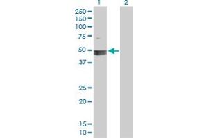 Western Blot analysis of SMARCB1 expression in transfected 293T cell line by SMARCB1 MaxPab polyclonal antibody. (SMARCB1 antibody  (AA 1-385))