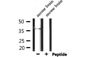 Western blot analysis of extracts from mouse brain, using OR4D5 Antibody.