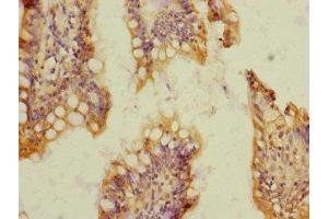 Immunohistochemistry of paraffin-embedded human small intestine tissue using ABIN7170776 at dilution of 1:100 (SOAT2 antibody  (AA 1-120))