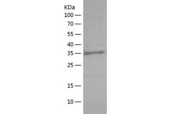 HIF1A Protein (AA 574-799) (His tag)