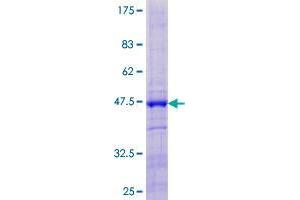 DBF4B/DRF1 Protein (AA 1-170) (GST tag)