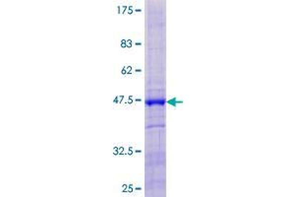 DBF4B/DRF1 Protein (AA 1-170) (GST tag)