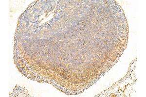 ABIN6261598 and ABIN6266535 at 1/100 staining Rat kidney tissue by IHC-P. (ERK1/2 antibody  (C-Term))